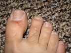 damaged foot.jpg